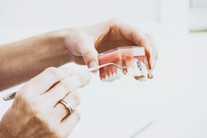 Ile kosztują implanty zębów? Implanty - cena